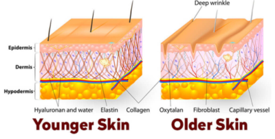 ageing skin