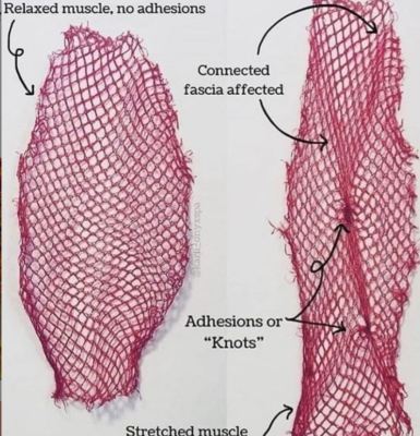 fascia