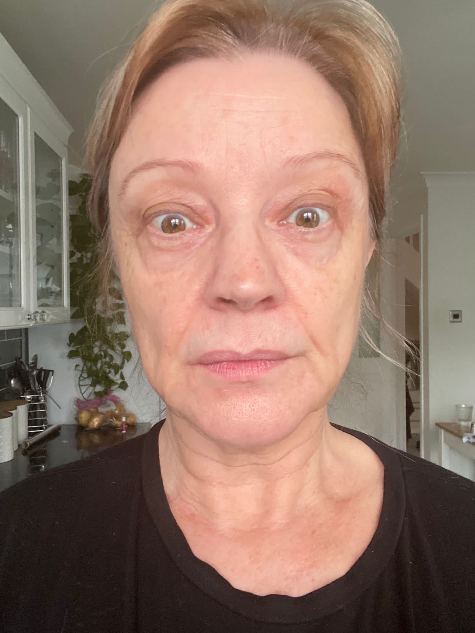 before and after face yoga