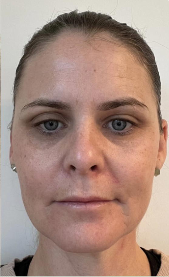 face after face yoga