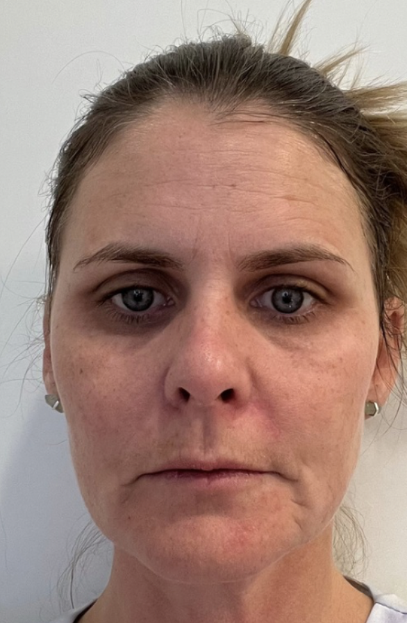 face before face yoga